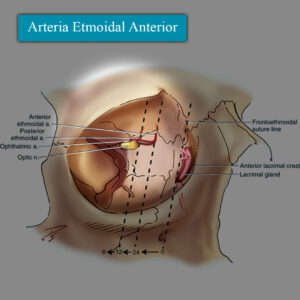 Arteria etmoidal anterior en esquema 2