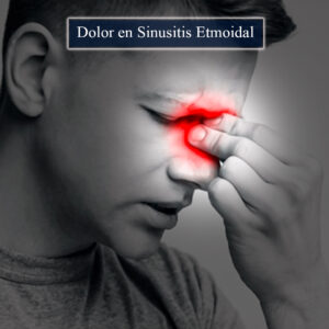 Dolor en sinusitis etmoidal