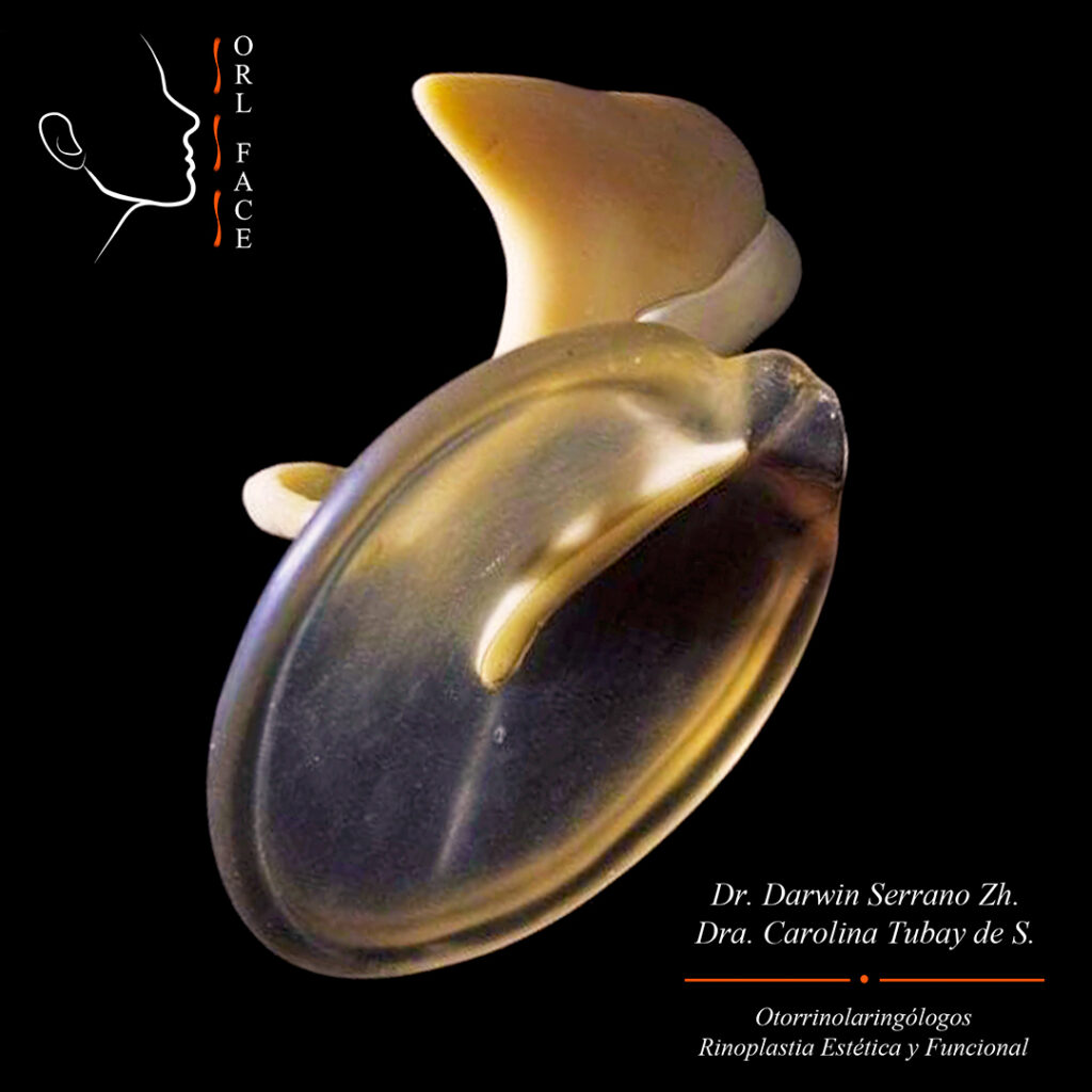 Dr. Darwin Serrano Zh. Dra. Carolina Tubay de S. Otorrinolagingologo, Otorrino. orlface. Manta. Salinas. Membrana Timpánica