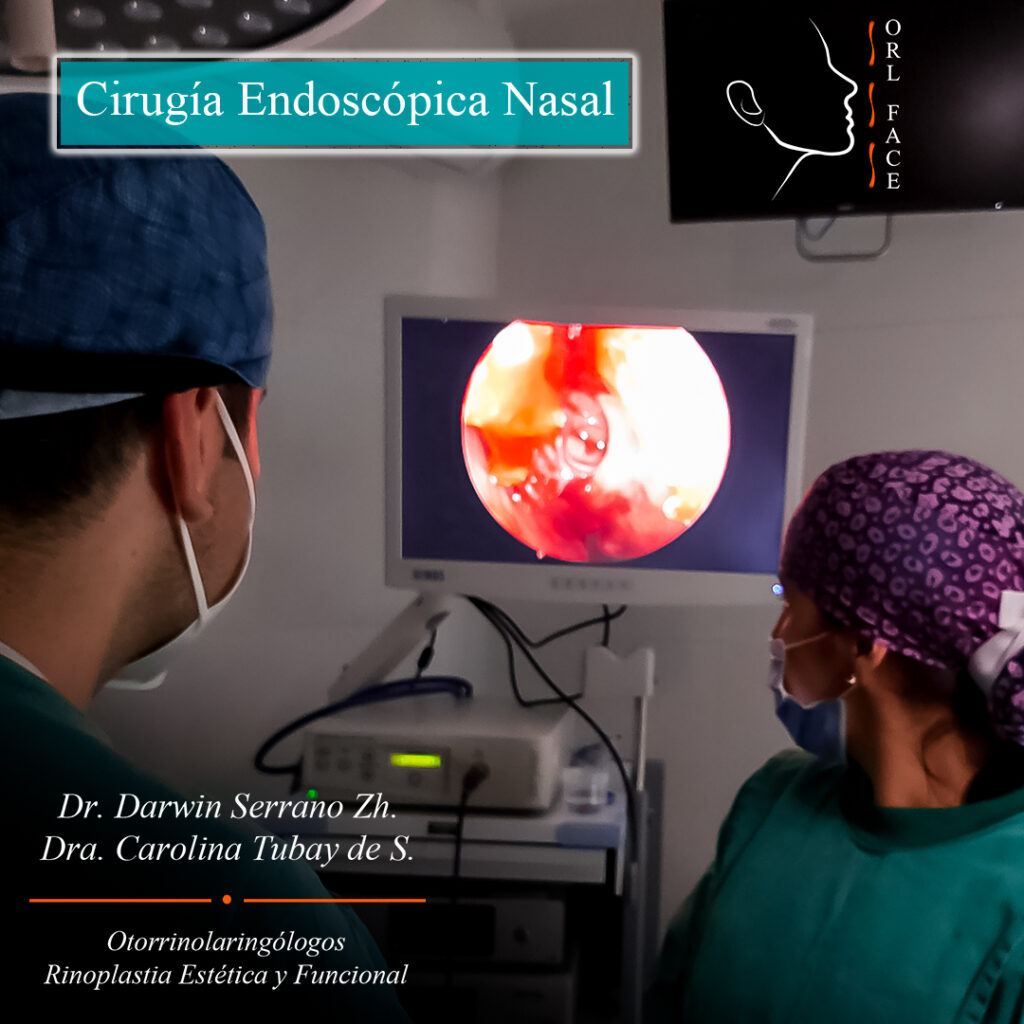 Dr. Darwin Serrano Zh. Dra. Carolina Tubay de S. Otorrinolaringologia, orl face, FESS Cirugía endoscópia nasal, arteria etmoidal anterior