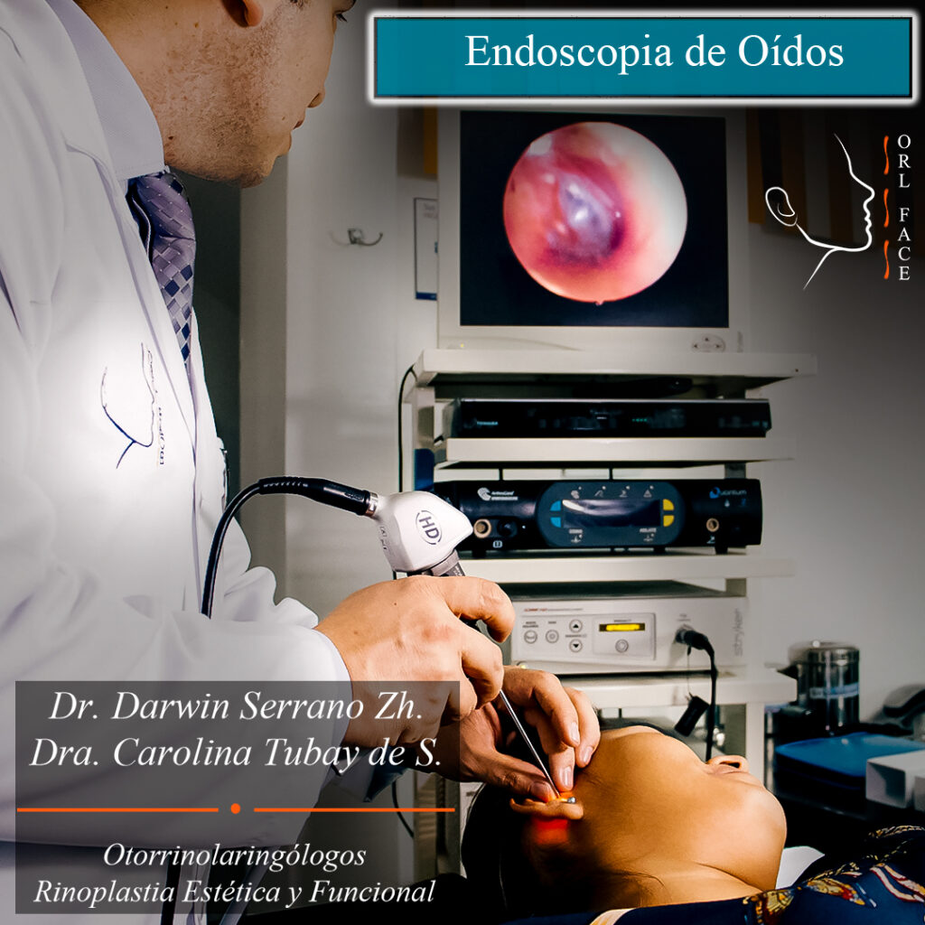 Endoscopia de oídos. Dr. Darwin Serrano Zh. Dra. Carolina Tubay de S. OTORRINOLARINGÓLOGOS. rinoplastia salinas orlface