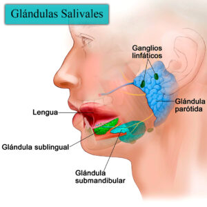 Dr. Darwin Serrano Zh. Dra. Carolina Tubay de S. Otorrinolagingologo, Otorrino. orlface. Manta. Salinas. Tumor de Glándulas Salival (Submaxilectomía):