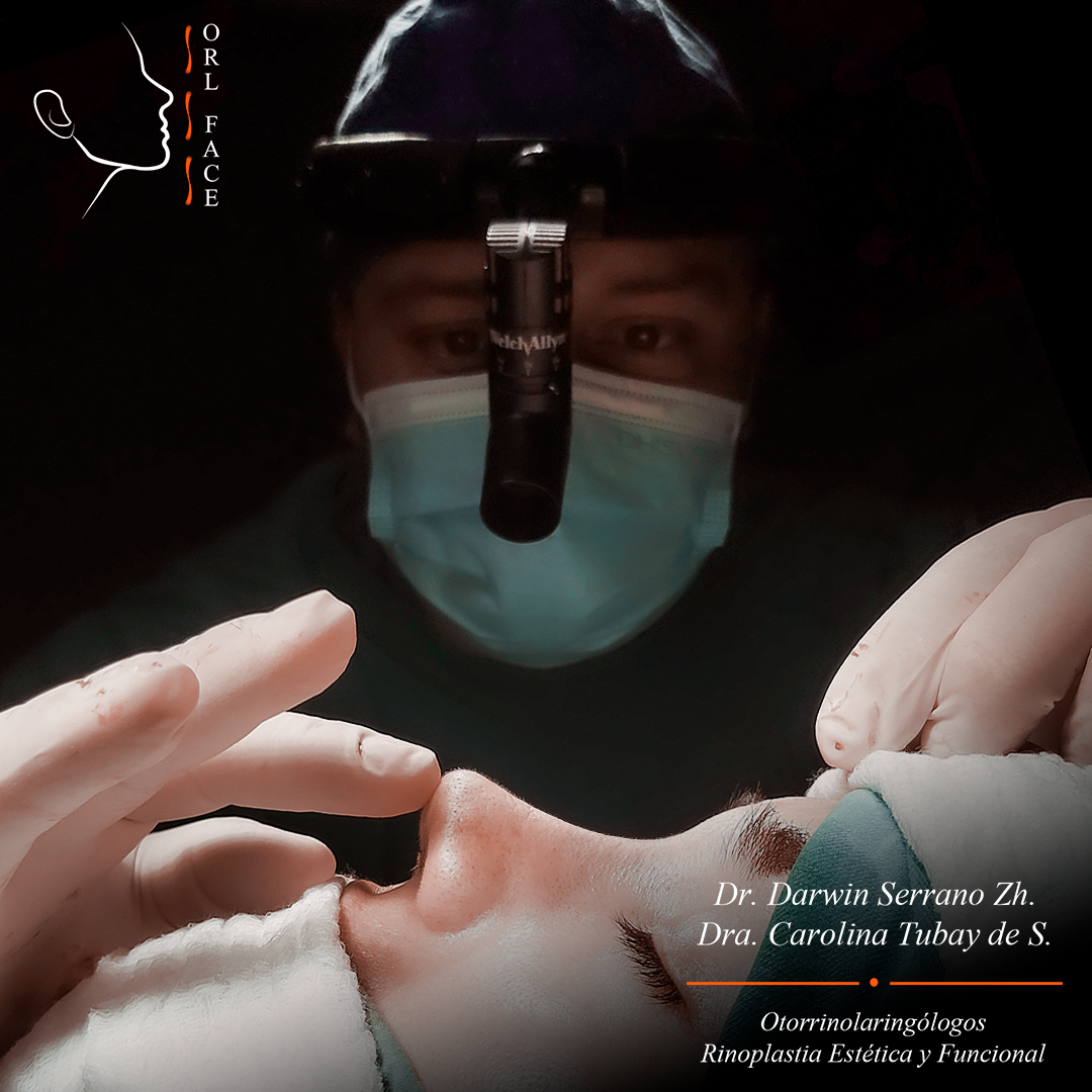 Otorrinolagingologo, Otorrino. orlface. santa elena. Salinas. Rinoplastia.