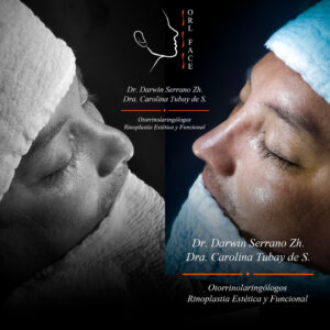 Dr. Darwin Serrano Zh. Dra. Carolina Tubay de S. Otorrinolagingologo, Otorrino. orlface. Manta. Salinas. Rinoplastia.