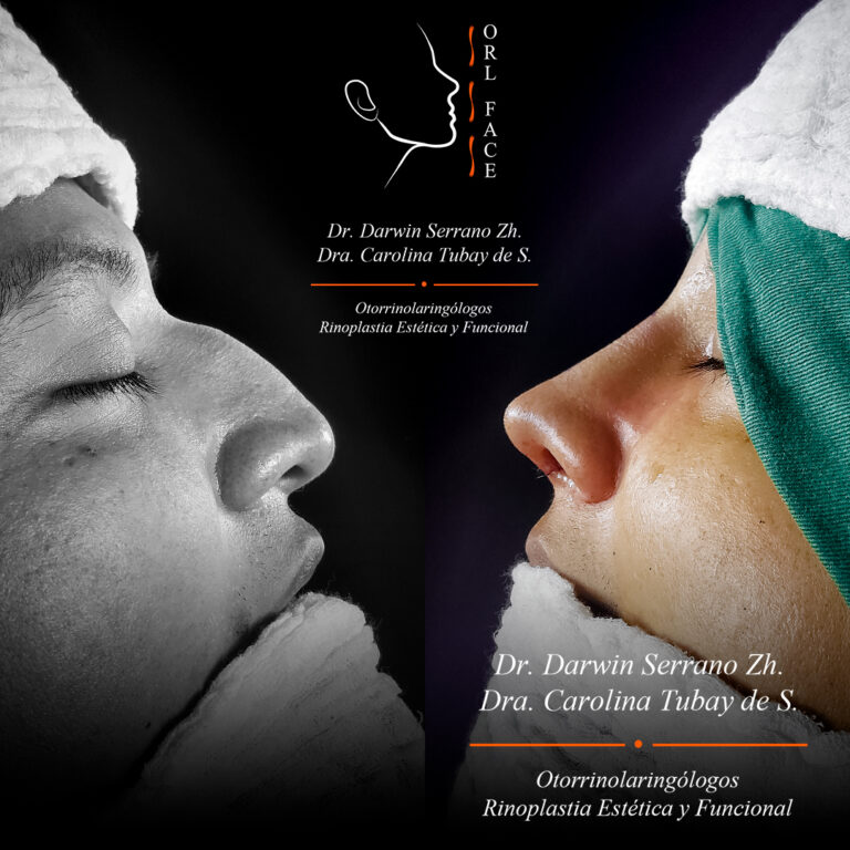 Dr. Darwin Serrano Zh. Dra. Carolina Tubay de S. Otorrinolagingologo, Otorrino. orlface. Manta. Salinas. Rinoplastia.