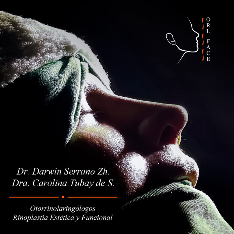 Dr. Darwin Serrano Zh. Dra. Carolina Tubay de S. Otorrinolagingologo, Otorrino. orlface. Manta. Salinas. Rinoplastia.