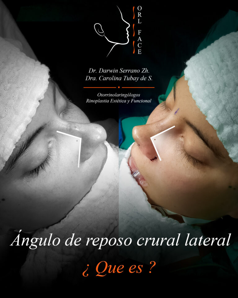 Dr. Darwin Serrano Zh. Dra. Carolina Tubay de S. Otorrinolagingologo, Otorrino. orlface. Manta. Salinas. Rinoplastia.
