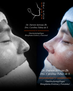 Dr. Darwin Serrano Zh. Dra. Carolina Tubay. Otorrinolaringologo, Otorrino. Salinas. Cirugia estetica nasal.
