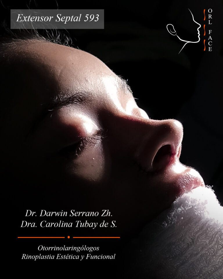 Dr. Darwin Serrano Zh. Dra. Carolina Tubay. Otorrinolaringologo, Otorrino. Salinas. Cirugia estetica nasal.